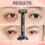 SilkGlow™ Red Light Facial & Eye Therapy Wand