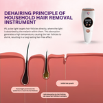 SilkSmooth™ Ice Cool Laser Hair Removal Device